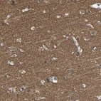 Immunohistochemical staining of human cerebral cortex shows strong granular cytoplasmic positivity in neuropil.