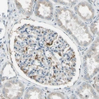 Immunohistochemical staining of human kidney shows strong granular cytoplasmic positivity in cells in glomeruli.
