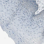 Immunohistochemical staining of human cervix, uterine shows negative to very weak no positivity in squamous epithelial cells as expected.