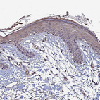 Immunohistochemical staining of human squamous epithelia shows weak nuclear positivity in squamous epithelial cells in addition to weak cytoplasmic positivity.