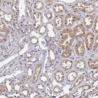 Immunohistochemical staining of human kidney shows moderate nuclear positivity in cells in tubules in addition to moderate cytoplasmic positivity.