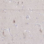 Immunohistochemical staining of human cerebral cortex shows weak nuclear positivity in neuronal cells in addition to cytoplasmic positivity.