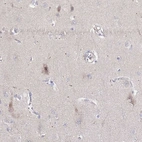 Immunohistochemical staining of human cerebral cortex shows weak nuclear positivity in neuronal cells in addition to cytoplasmic positivity.