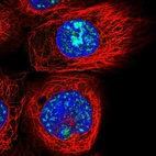 Immunofluorescent staining of human cell line A-431 shows localization to nucleoli & nuclear speckles.