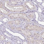 Immunohistochemical staining of human kidney shows weak cytoplasmic positivity and moderate nucleus positivity in subset of cells in cells in tubules.