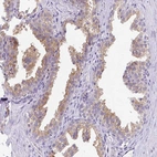 Immunohistochemical staining of human prostate shows moderate to strong positivity in cytoplasm in glandular cells.