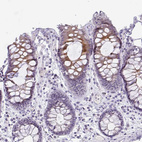 Immunohistochemical staining of human colon shows moderate cytoplasmic positivity in glandular cells.