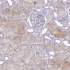 Immunohistochemical staining of human kidney shows moderate cytoplasmic positivity in cells in tubules.
