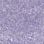 Immunohistochemical staining of human tonsil shows no positivity in non-germinal center cells.