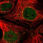 Immunofluorescent staining of human cell line CACO-2 shows localization to nucleoplasm & vesicles.