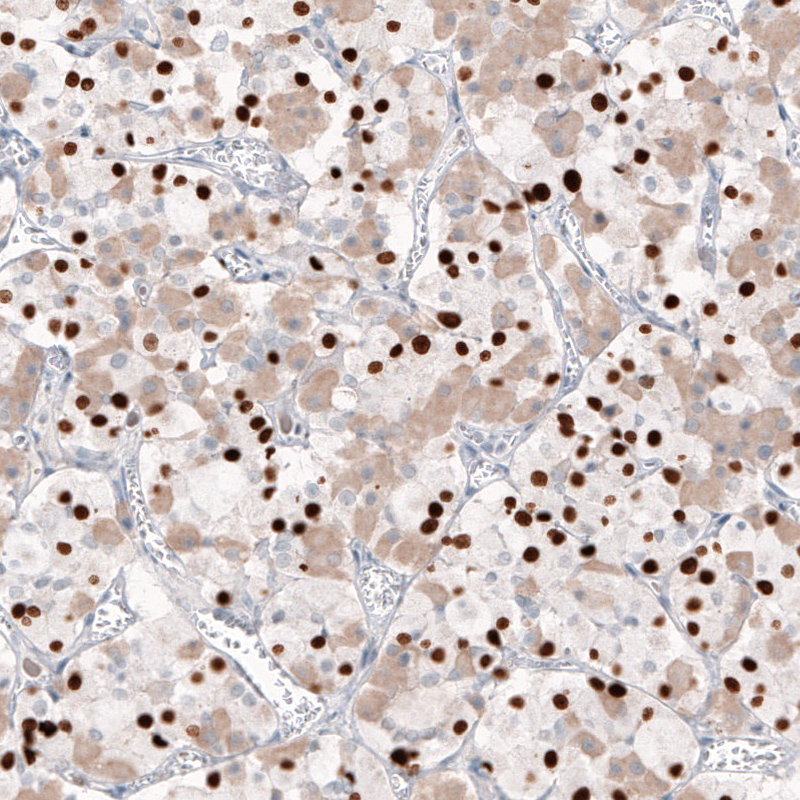 Anti-TBX19 Recombinant Antibody