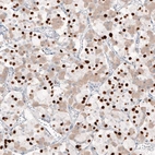 Anti-TBX19 Recombinant Antibody