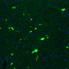 Immunofluorescence staining of mouse brain shows strong positivity in acetylcholine neurons in the basal forebrain.