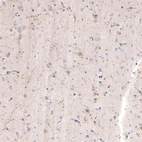 Immunohistochemical staining of human cerebral cortex shows moderate positivity in cholinergic neural fibers.