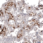 Immunohistochemical staining of human placenta shows strong cytoplasmic positivity in a subset of cells in chorionic villi.