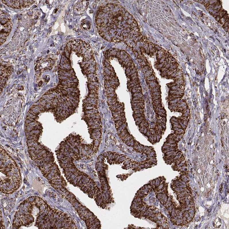 Anti-TUFM Recombinant Antibody