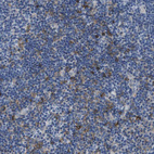 Immunohistochemical staining of human tonsil shows moderate membranous-cytoplasmic positivity in subset of non-germinal center cells.