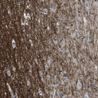 Immunohistochemical staining of human cerebral cortex shows strong membranous-cytoplasmic positivity in neuropil.