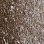 Immunohistochemical staining of human cerebral cortex shows strong membranous-cytoplasmic positivity in neuropil.