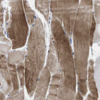 Immunohistochemical staining of human skeletal muscle shows strong cytoplasmic positivity in myocytes.