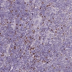 Immunohistochemical staining of human tonsil shows strong nuclear positivity in non-germinal center cells.