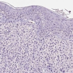 Immunohistochemical staining of human skin shows no positivity in squamous epithelial cells as expected.