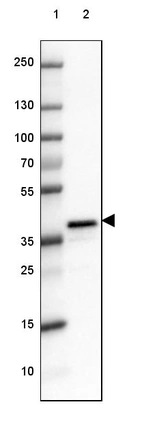 Lane 1: Marker [kDa] 250, 130, 100, 70, 55, 35, 25, 15, 10_br/_Lane 2: Human cell line NTERA-2
