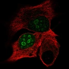 Immunofluorescent staining of human cell line PC-3 shows localization to nucleus & nucleoli.