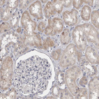 Immunohistochemical staining of human kidney shows weak cytoplasmic positivity in cells in tubules.