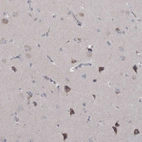 Immunohistochemical staining of human cerebral cortex shows moderate cytoplasmic positivity in neurons.