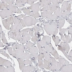 Immunohistochemical staining of human skeletal muscle shows no positivity in myocytes.