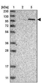 Lane 1: Marker [kDa] 230, 130, 95, 72, 56, 36, 28, 17, 11_br/_Lane 2: Human cell line RT-4_br/_Lane 3: Human cell line U-251MG sp