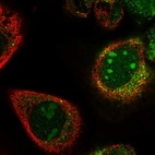 Immunofluorescent staining of human cell line A-431 shows localization to nucleoli & cytosol.