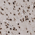 Immunohistochemical staining of human cerebral cortex shows strong nuclear positivity in neuronal cells in addition to cytoplasmic positivity.