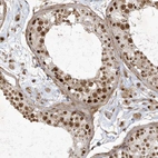 Immunohistochemical staining of human testis shows strong nuclear/nucleoli positivity in cells in seminiferous ducts and Leydig cells.