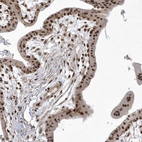 Immunohistochemical staining of human placenta shows strong nuclear/nucleoli positivity in trophoblastic cells.
