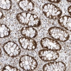 Immunohistochemical staining of human colon shows strong nuclear/nucleoli positivity in glandular cells and lymphoid cells.