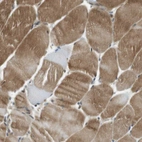Immunohistochemical staining of human skeletal muscle moderate cytoplasmic positivity in myocytes.
