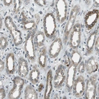 Immunohistochemical staining of human kidney shows moderate membranous-cytoplasmic positivity in cells in tubules.