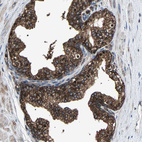 Immunohistochemical staining of human prostate shows strong membranous positivity in glandular cells.