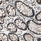 Immunohistochemical staining of human rectum shows strong membranous positivity in glandular cells.