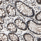 Immunohistochemical staining of human rectum shows strong membranous positivity in glandular cells.