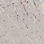 Immunohistochemical staining of human cerebellum shows moderate membranous-cytoplasmic positivity in endothelial cells.