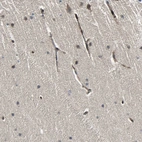 Immunohistochemical staining of human cerebellum shows moderate membranous-cytoplasmic positivity in endothelial cells.