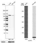 Western blot analysis in human cell lines A-431 and HEK293 using Anti-ACTN1 antibody. Corresponding ACTN1 RNA-seq data are presented for the same cell lines. Loading control: Anti-GAPDH.