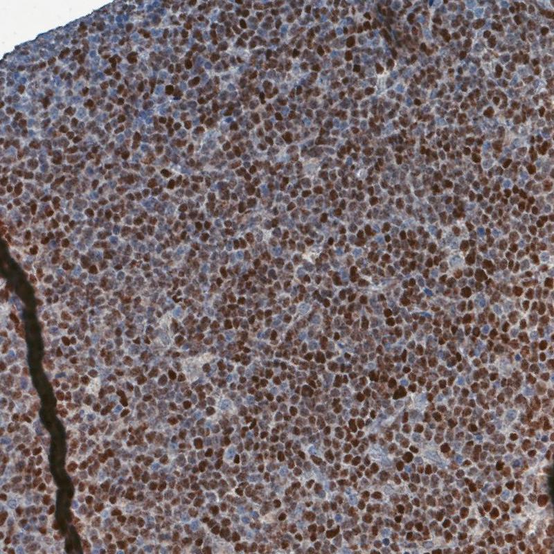 Anti-SOX11 Recombinant Antibody