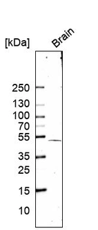 Western blot analysis in human brain tissue.