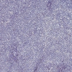 Immunohistochemical staining of human chronic lymphocytic leukemia shows no nuclear positivity in tumor cells as expected.