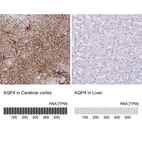 Anti-AQP4 Recombinant Antibody