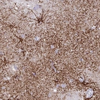 Immunohistochemical staining of human cerebral cortex shows moderate to strong membranous positivity in astrocytes.
